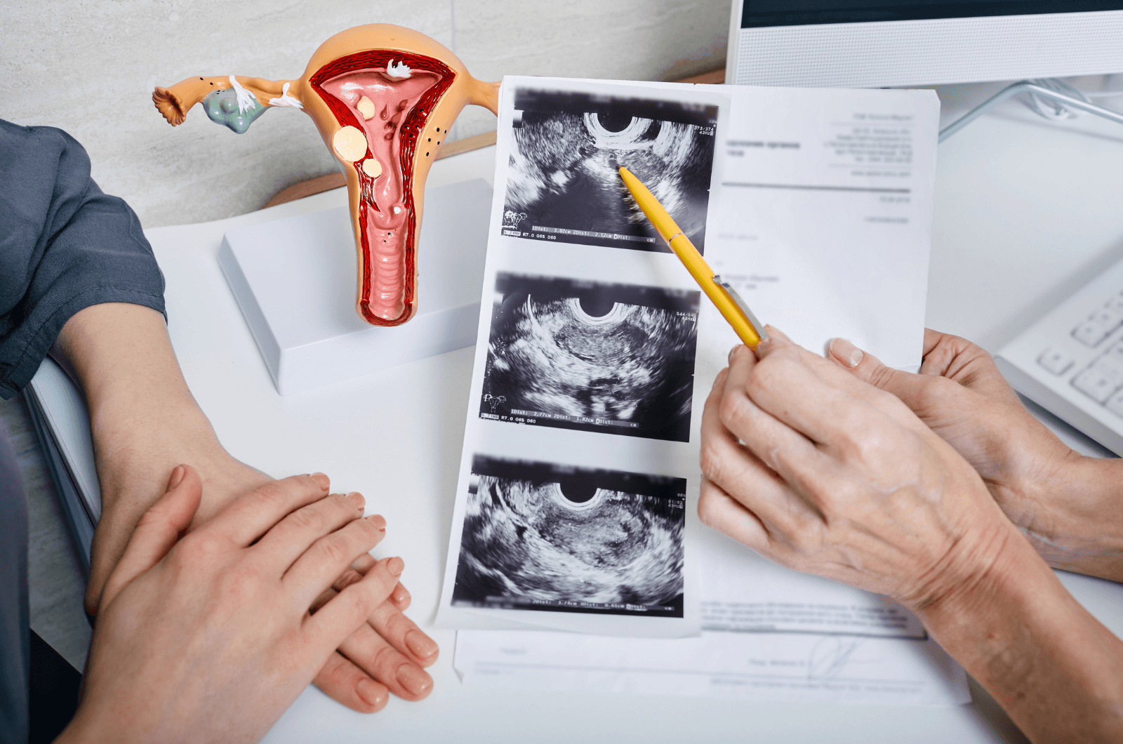 Visita dal Ginecologo a Torre del Greco Napoli